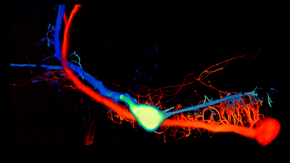 A photomicrograph of neurons.